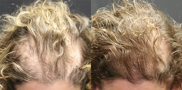 Before & After