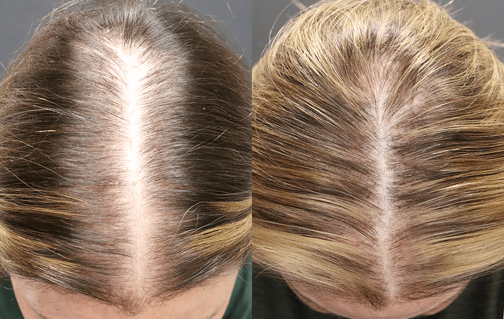 Before & After