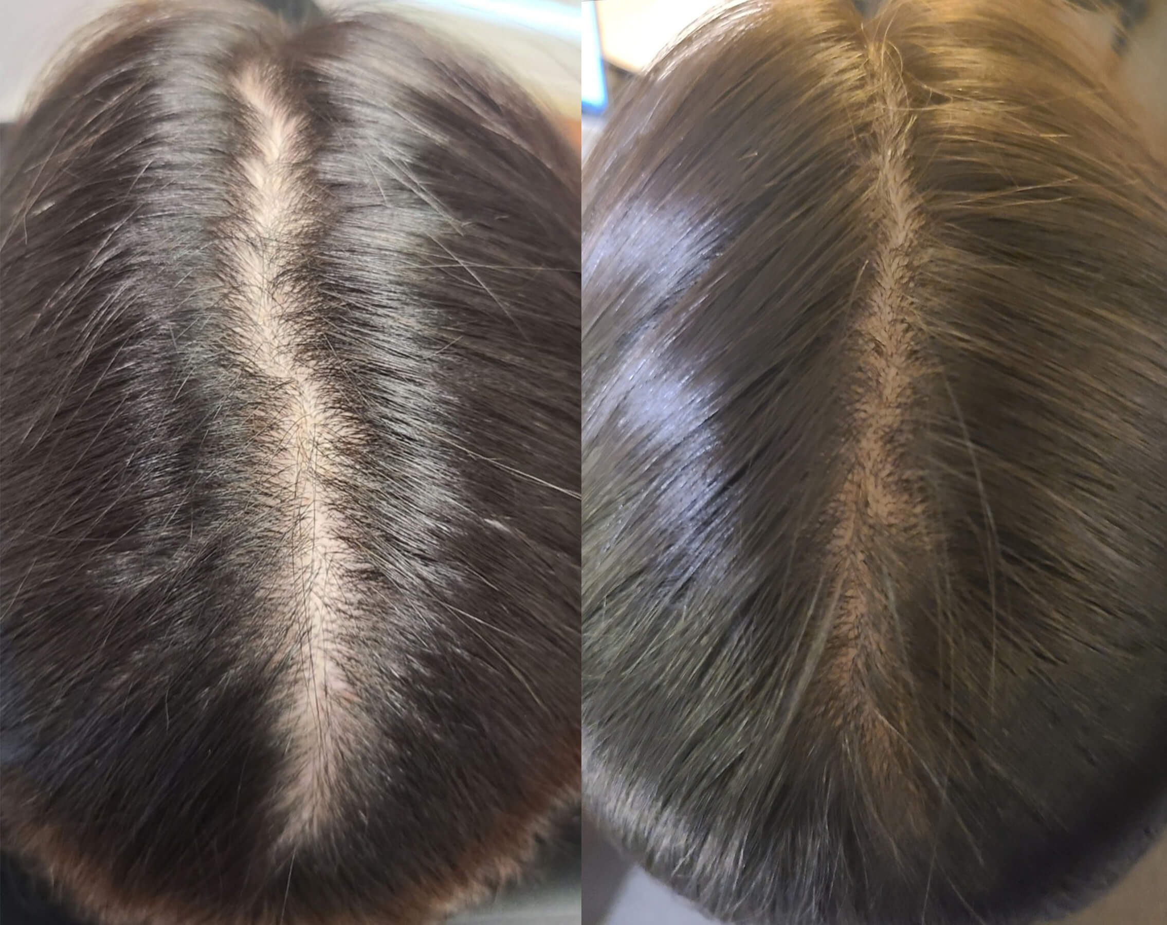 Before & After
