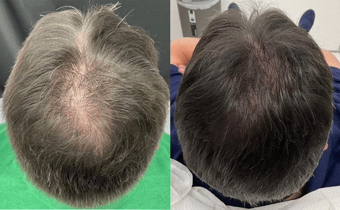 Before & After