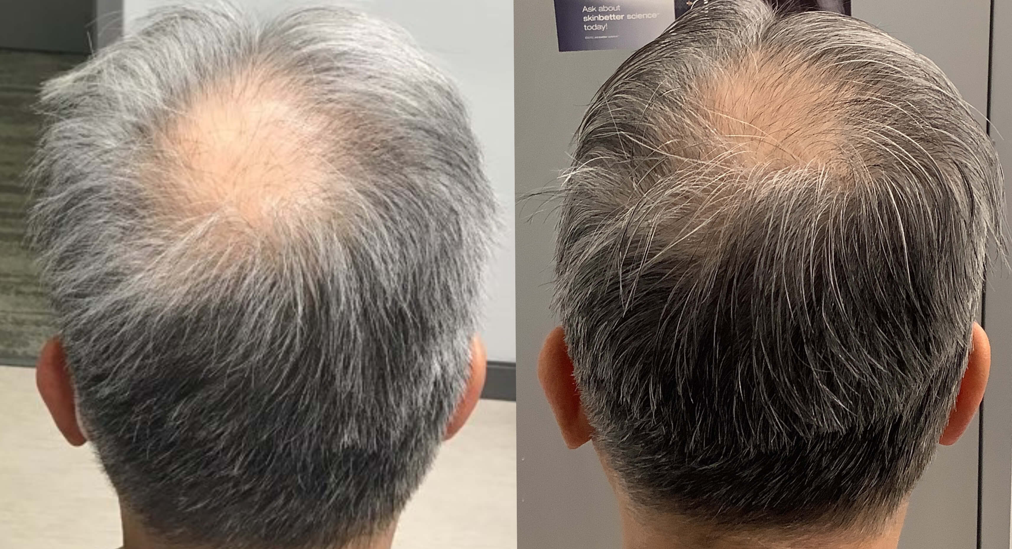 Before & After