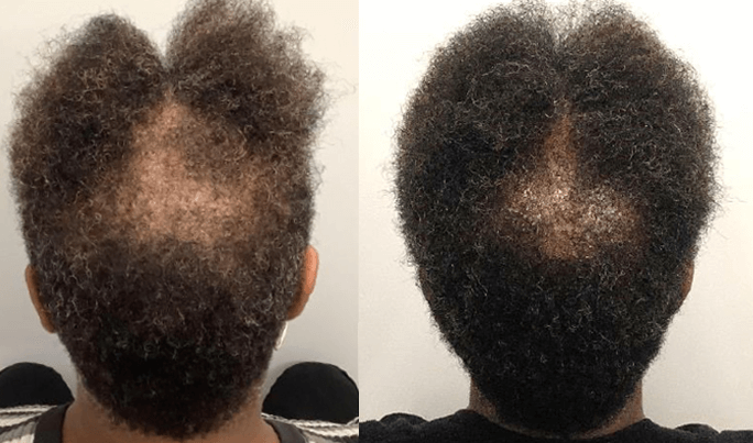 TED Before & After
